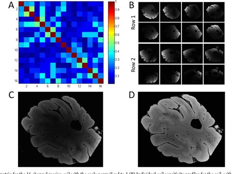 Figure 2 From High Resolution Anatomical And Quantitative Mri Of The