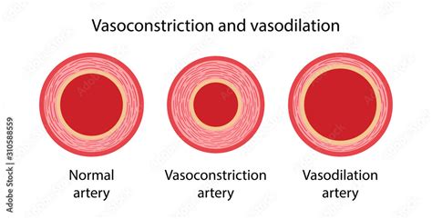 Arterial Vasoconstriction And Vasodilation Comparison Illustration Of