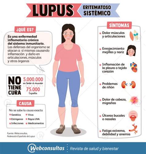 Lupus Qué Es Causas Y Consecuencias Salud