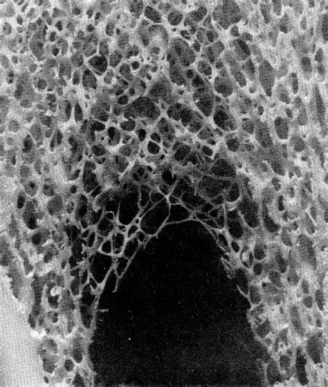 Jul 27, 2021 · cross section of the leg through the soleus muscle: CROSS SECTION OF A BONE THAT SHOWS THE SUBSTANIA SPONGIOSA ...
