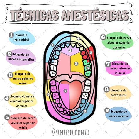 Anestesiologia anestesio técnicas odontologia Anatomia dental