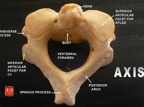 Looking for online definition of atlas vertebra in the medical dictionary? Difference Between Typical and Atypical Vertebrae ...