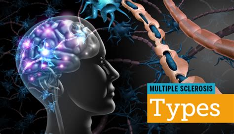 Multiple Sclerosis Types Mymsteam