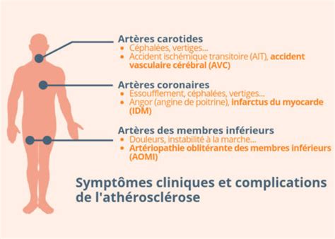 Les Symptômes Cliniques Et Les Complications De Lathérosclérose