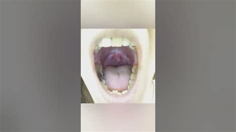 Uvula Girl Say Yahhahhh 👅 What Does Your Uvula Do After School Dangly