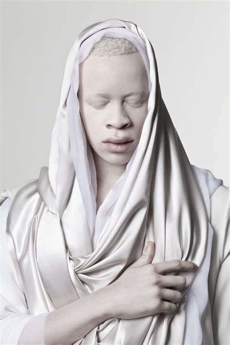 Hot Shots Albinosrock See Fabulous Creative Images Of Albino Models