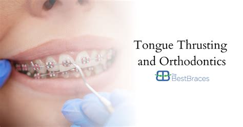 tongue thrusting and orthodontics the best braces orthodontists in southfield mi