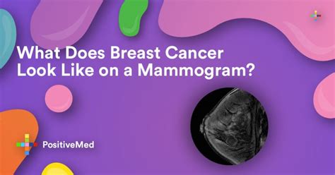 Not all breast cancers can be found on mammograms, especially in younger women who have more dense breast tissue. What Does Breast Cancer Look Like on a Mammogram ...