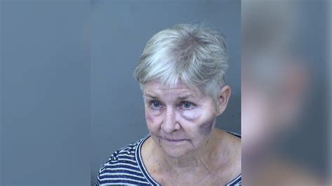 Police 71 Year Old Woman Accused Of Beating Husband Was ‘tired Of Taking Care Of Him