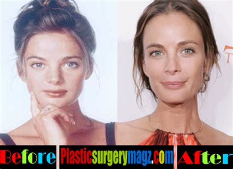 Gabrielle Anwar Plastic Surgery Before And After Plastic Surgery Magazine
