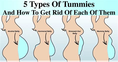 Types Of Tummies And How To Get Rid Of Them