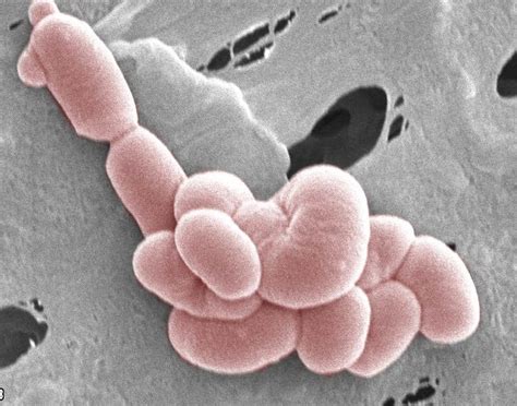 lactobacillus paracasei chto eto za bakterii preparaty kupit