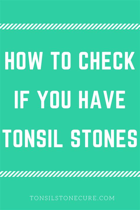 Pin On Tonsil Stone Cures
