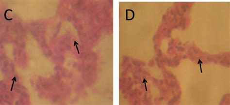 Representative Photomicrographs Of The Lungs Of The A B C And D