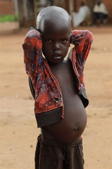 Perché I Bambini Africani Hanno La Pancia Gonfia I Bambini Di Manina