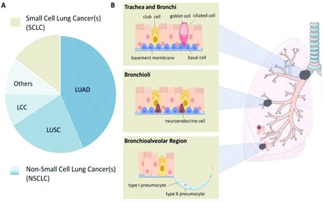 Histological Classification Of Lung Cancer A Lung Cancer