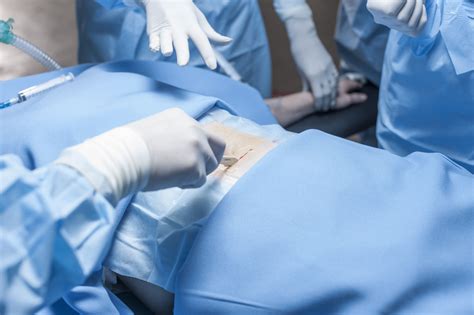 Tram Flap Breast Reconstruction Uses Procedure Results