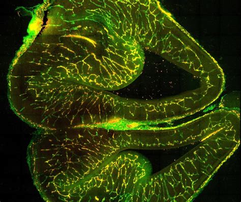 Treatment for blood clots depend on the cause. Brothers in arms: The brain and its blood vessels