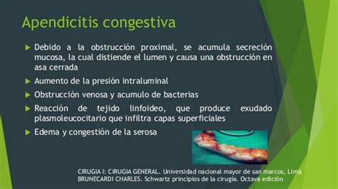 Apendicitis Agudo