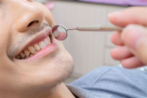 Dentist Check Ups And Cleans In Taylors Lakes Checkup Gardens Dental