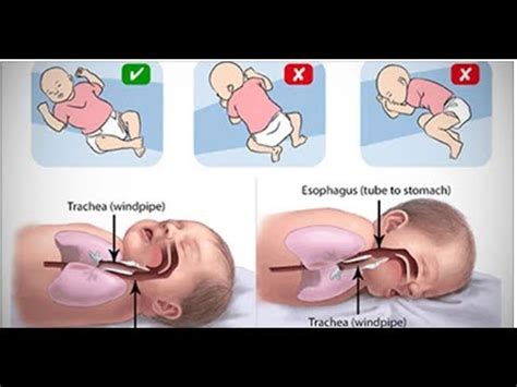 A síndrome da morte súbita em bebês o que você pode fazer para evitar