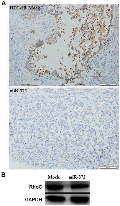 effects of mir 372 transfection in vivo immunohistochemical and download scientific diagram