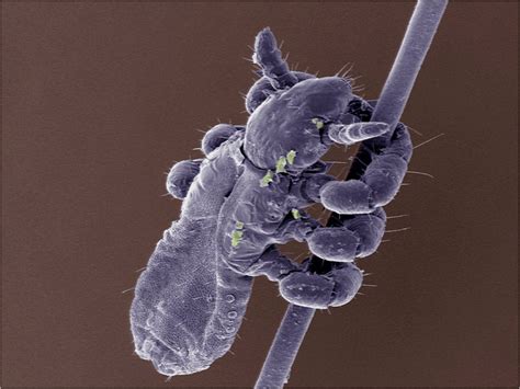 Head Lice Under Electron Microscope Micropedia