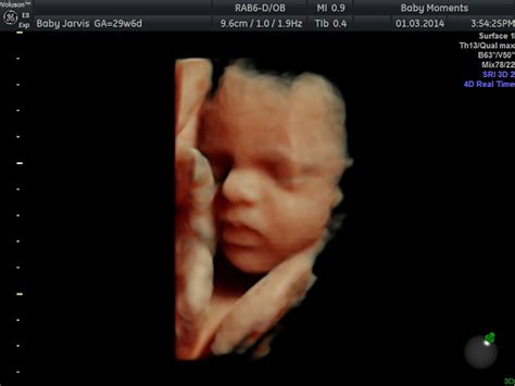 2d3d4d Wellbeing Package Baby Moments 3d 4d Ultrasound Scan Centre