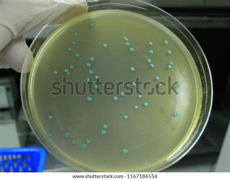 4 Aloa Agar Plate Images Stock Photos 3d Objects And Vectors