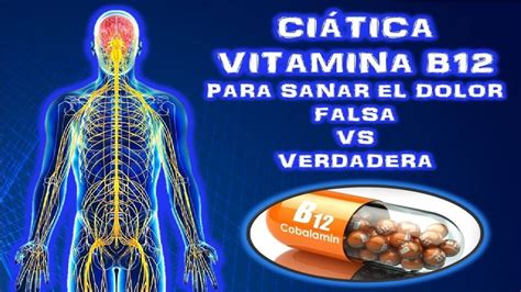 Ciatica Vitamina B12 Tratamiento Para El Dolor De CiÁtica Falso Vs Verdadero Youtube