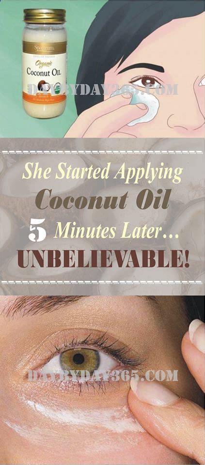 Amazing Read And Repin She Started Applying Coconut Oil Around Her Eyes
