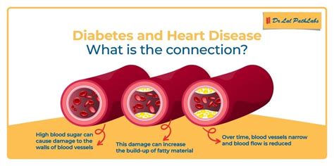 Diabetes And Heart Diseases How Diabetes Affects The Heart Dr Lal