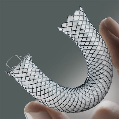 New Stents Deal To End Agony Of Throat Cancer Patients