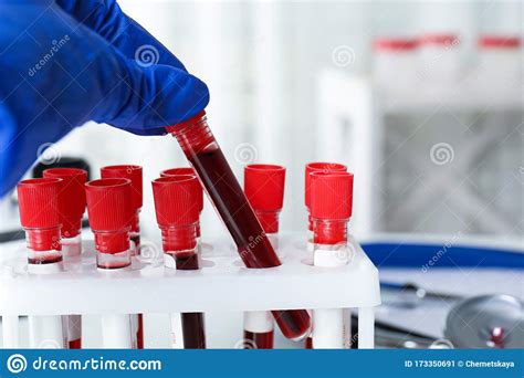 Wissenschaftler Der Reagenzglas Mit Bluttest Aus Dem Rack Im Labor Wird Virusforschung