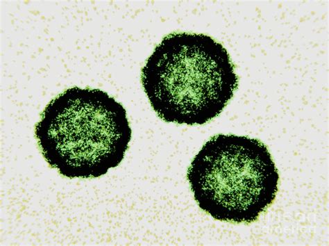 Coxsackievirus Virus Particles Photograph By Juan Gaertner Science Photo Library Fine Art America
