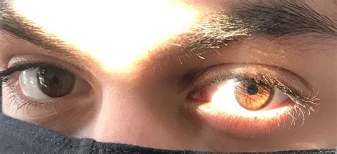 Brown Eyes At 700 Normal Lighting Vs Sunlight Reyes