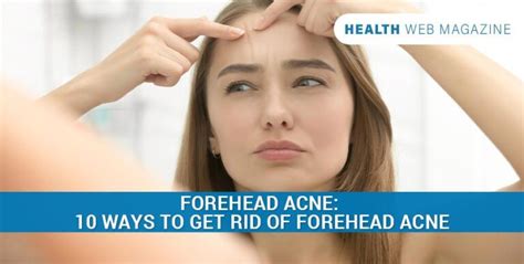 What Causes Forehead Acne And How To Treat It