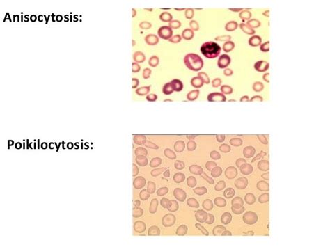 Morphology Of Red Blood Cells