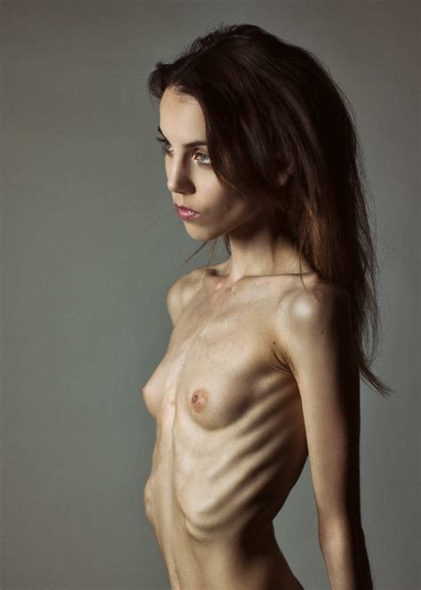 Anorexic Nude Naked Topless Telegraph