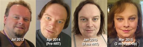 How Hormones Hrt Change A Trans Womans Body Natural Testosterone