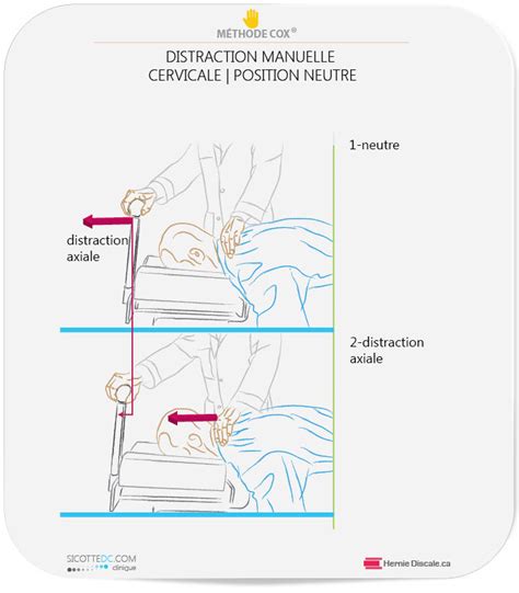 Douleur dans ma main gauche avec fourmillement et devient bleu. ARTHROSE CERVICALE - DOULEUR AU BRAS AVEC SYMPTÔME ...