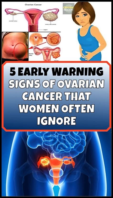 Five Early Warning Signs Of Ovarian Cancer You Should Never Ignore