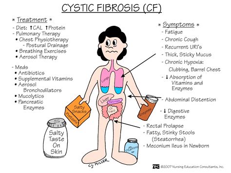 A Guide To Cystic Fibrosis CF For First Aiders First Aid For Free