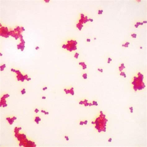 Carolina Biological Supply Company Gram Negative Bacillus Slide Gram