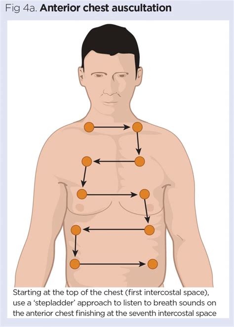 Where To Auscultate Lung Sounds