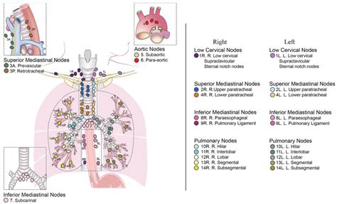 Figure 1 From Role Of Ebus Tbna In Non Neoplastic Mediastinal