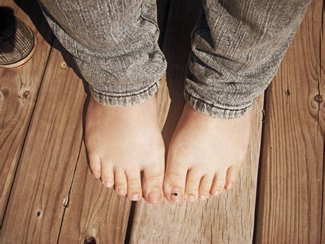 My Foottoes By Simplethingsfeet On Deviantart