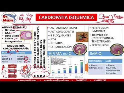 Qx Cardiologia TRATAMIENTO SICA YouTube