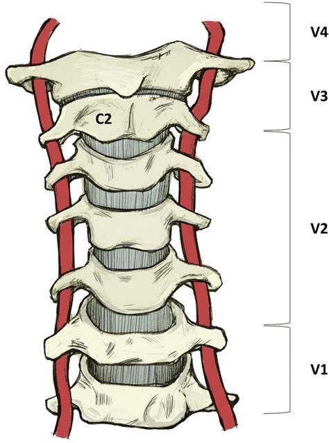Course Of The Vertebral Artery Through The Cervical Spine Download Scientific Diagram