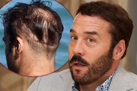 Celebrities Who Are Covering Up Their Bald Spots And Receding Hairlines
